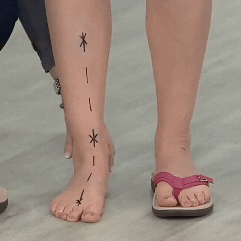 Chaussures d'été orthopédiques pour soutien et respirabilité